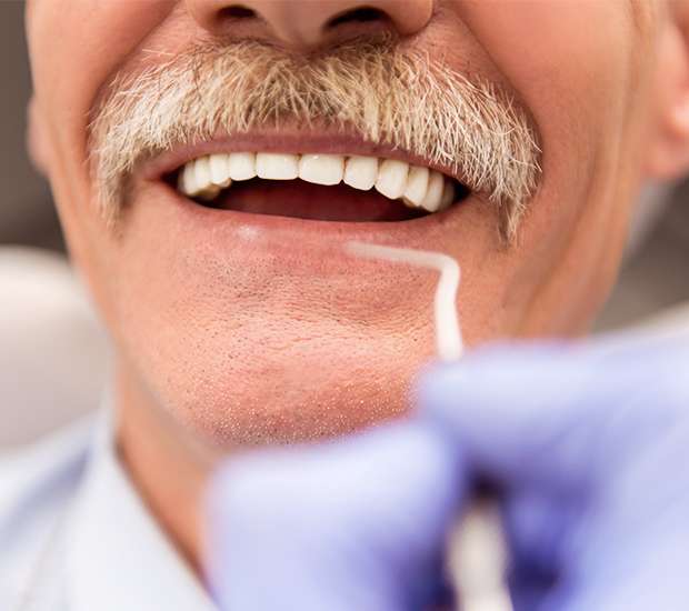 Santa Clarita Adjusting to New Dentures