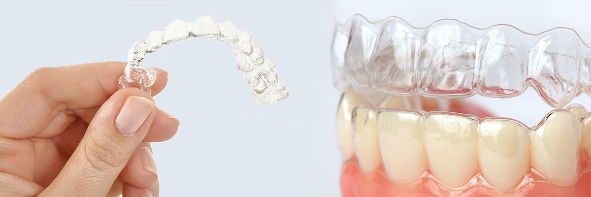 Santa Clarita Alternative to Braces for Teens