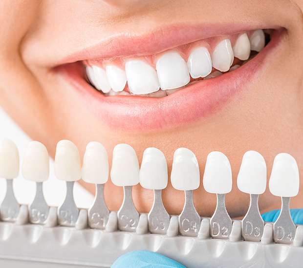 Santa Clarita Cosmetic Dentist