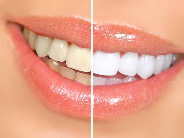 Perfect Smiles Dental Studio