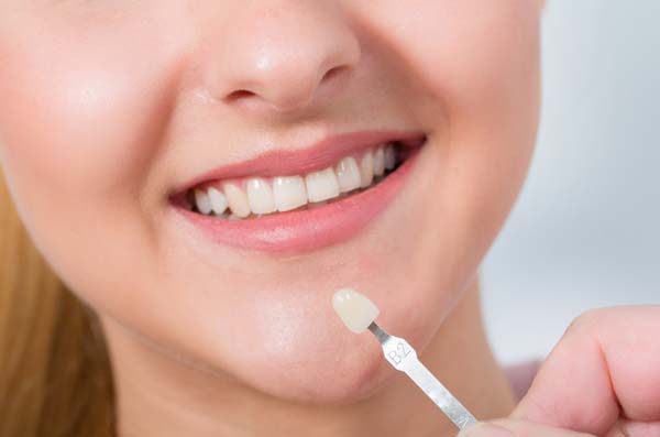 Dental Veneers Are A Cosmetic Dentistry Solution For Damaged Teeth