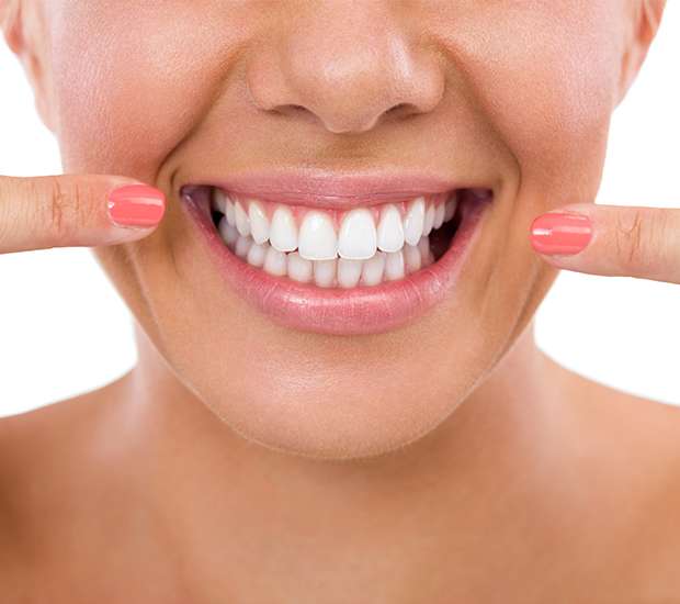 Santa Clarita What Is Gum Contouring and Reshaping