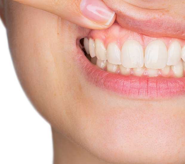 Santa Clarita Gum Disease