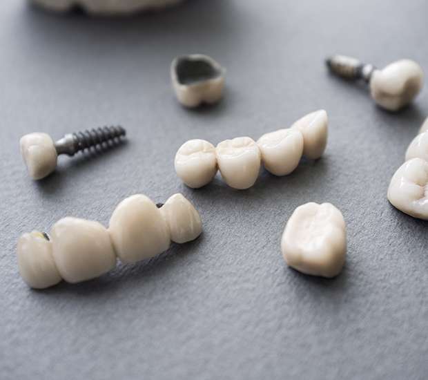 Santa Clarita The Difference Between Dental Implants and Mini Dental Implants