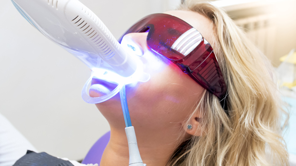 The Benefits Of Laser Dentistry For Cavity Treatment