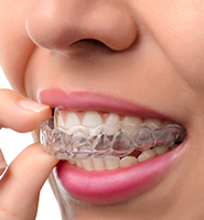 Clear Aligners - Almost Invisible Braces Santa Clarita, CA