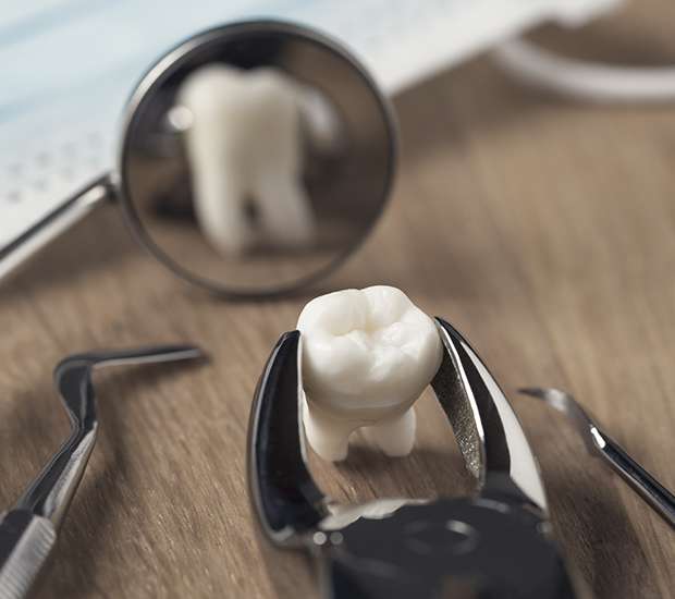 Santa Clarita When Is a Tooth Extraction Necessary